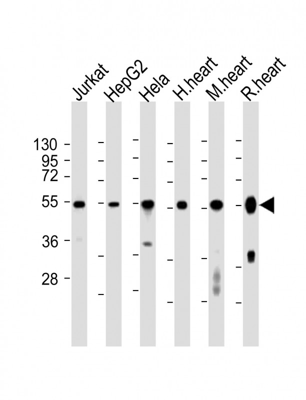 WB - OXCT1 Antibody (Center) AP21464c